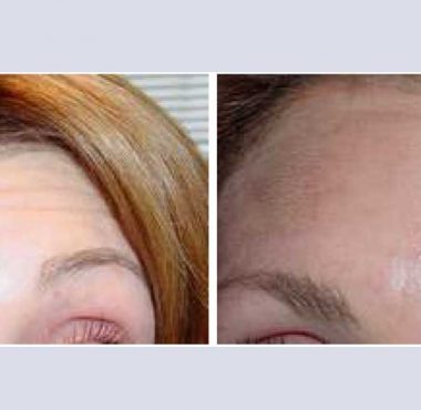 recosmo-before-after-aging-2