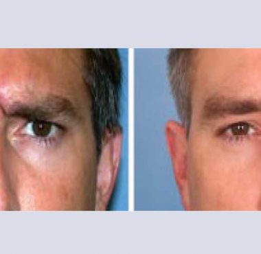 recosmo-before-after-aging-3